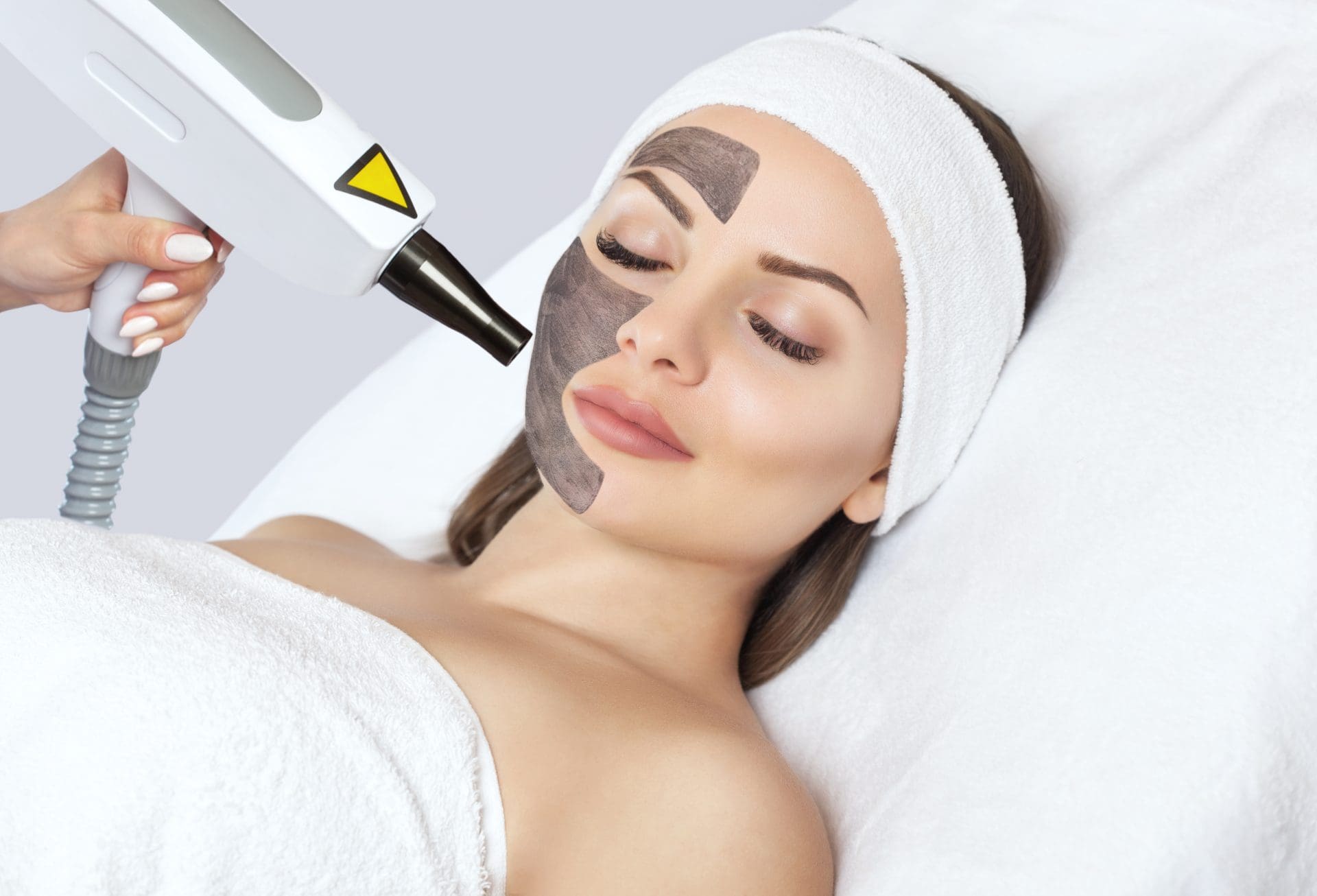 Laser Skin Treatments - Laser Carbon Peeling