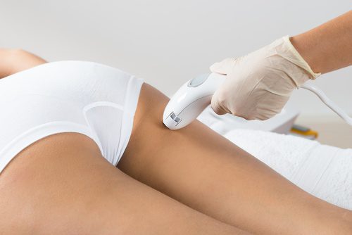 Laser Hair Removal for Buttocks, Buttocks Laser Hair Removal, Laser Hair Removal Buttocks