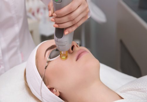Laser shop blackhead removal