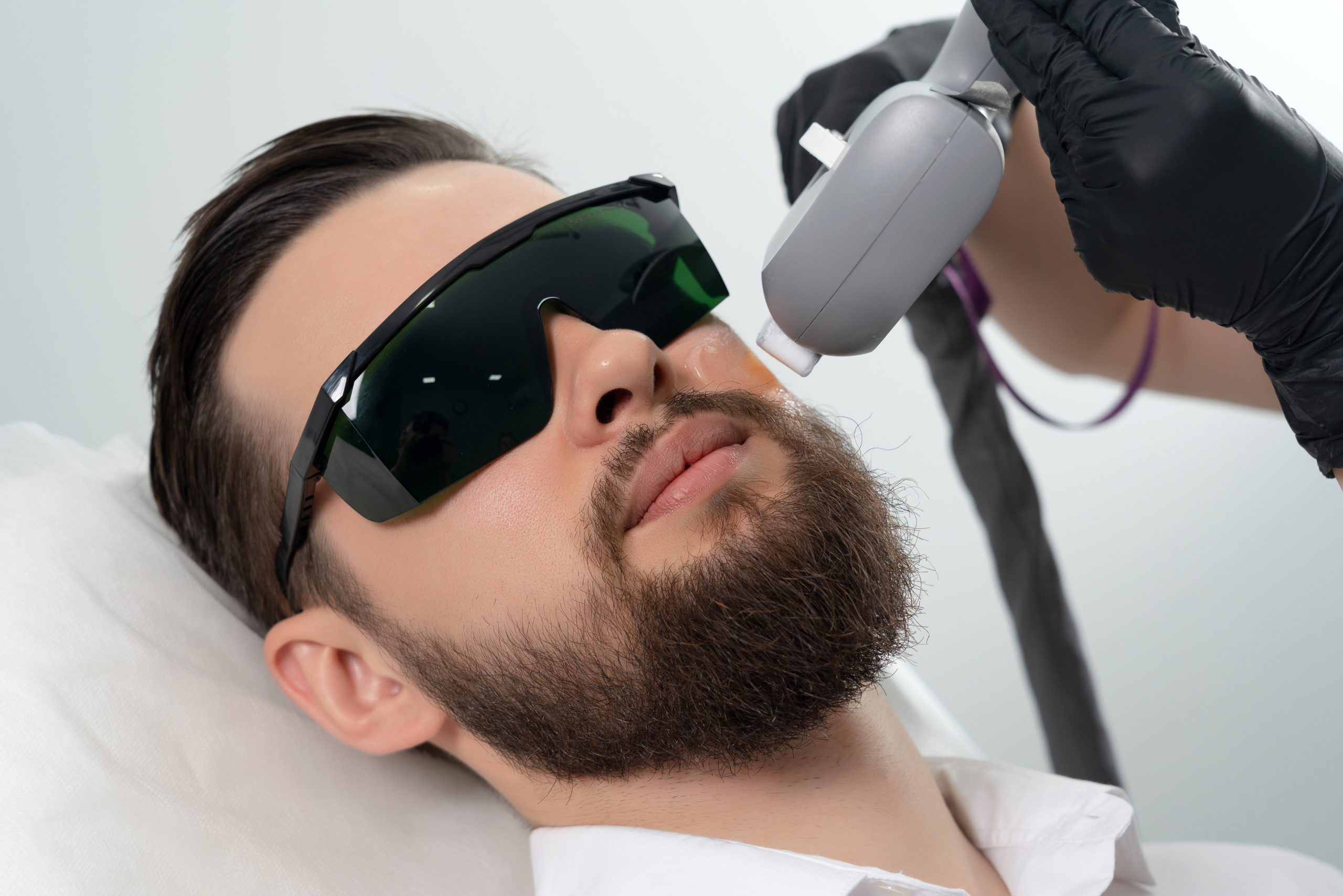 Man Receiving Laser Hair Removal for Beard