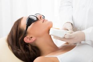 Laser Hair Removal for Chin at iLuvo Beauty Laser Clinic