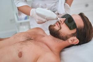 Nose Laser Hair Removal