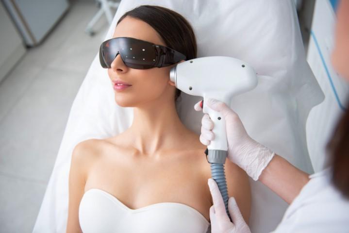 Sideburns Laser Hair Removal