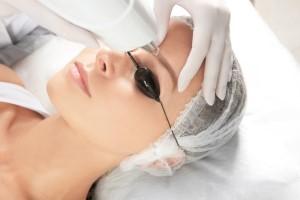 Monobrow/Unibrow Laser Hair Removal